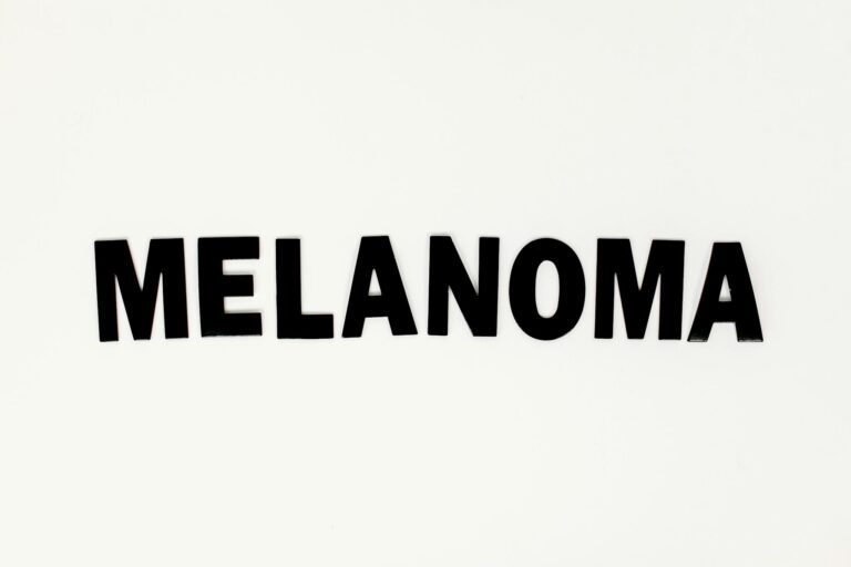 Minimalist image of the word 'Melanoma' in black letters on a white background.